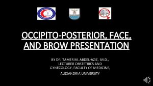 Types of brow presentation