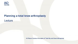 Planning a total knee arthroplasty Lecture AO Recon