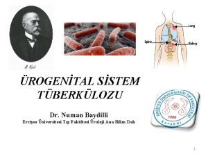 ROGENTAL SSTEM TBERKLOZU Dr Numan Baydilli Erciyes niversitesi