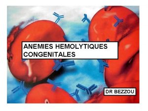 ANEMIES HEMOLYTIQUES CONGENITALES DR BEZZOU Traitement La splnectomie