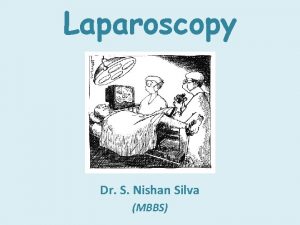 Laparoscopy Dr S Nishan Silva MBBS SHORT HISTORY