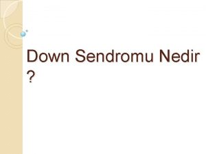 Down Sendromu Nedir Down Sendromu Nasl Oluur Sahip