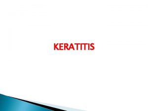 KERATITIS Keratitis Inflammation of cornea characterized by moderate