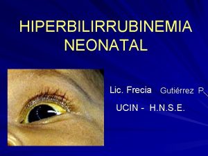 HIPERBILIRRUBINEMIA NEONATAL Lic Frecia Gutirrez P UCIN H