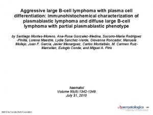 Aggressive large Bcell lymphoma with plasma cell differentiation