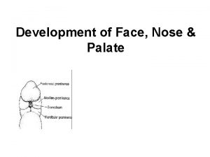 Development of secondary palate