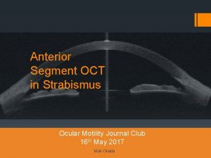 Anterior Segment OCT in Strabismus Ocular Motility Journal