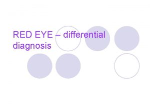 RED EYE differential diagnosis RED EYE l Red