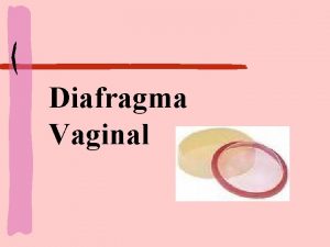 Diafragma Vaginal Histrico do Diafragma As barreiras vaginais