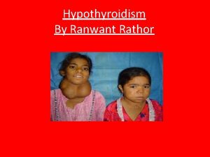 Hypothyroidism ronaldo