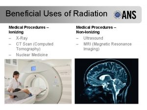 Beneficial Uses of Radiation Medical Procedures Ionizing Medical