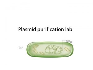 Plasmid purification lab Plasmid What is the plasmid
