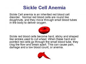 Sickle Cell Anemia Sickle Cell anemia is an