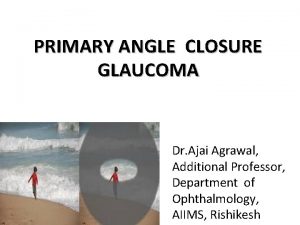 PRIMARY ANGLE CLOSURE GLAUCOMA Dr Ajai Agrawal Additional