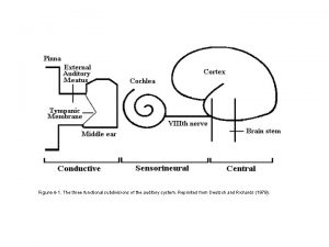 Tympanic sulcus