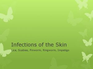 Infections of the Skin Lice Scabies Pinworm Ringworm