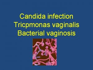 Candida infection Tricpmonas vaginalis Bacterial vaginosis Type of