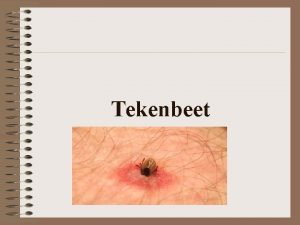 Tekenbeet Wetenswaardigheden van een Teek Een Teek is