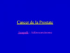 Cancer de la Prostate Anapath Adnocarcinome Epidmiologie Cancer