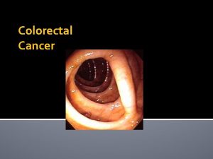 Colorectal Cancer Anatomy of the Colon and Rectum