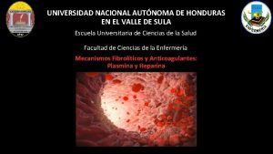 UNIVERSIDAD NACIONAL AUTNOMA DE HONDURAS EN EL VALLE