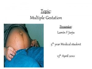 Topic Multiple Gestation Presenter Lamin F Jarju 5