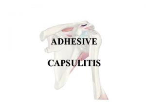 ADHESIVE CAPSULITIS Etiologia nieznana Czynniki predysponujce Urazy Unieruchomienie