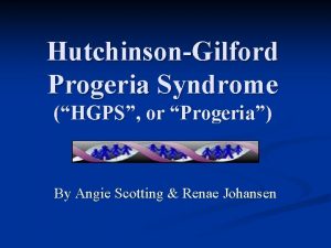 HutchinsonGilford Progeria Syndrome HGPS or Progeria By Angie