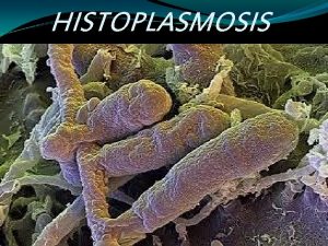 HISTOPLASMOSIS HISTOPLASMOSIS Darlings disease Causative fungus Histoplasma capsulatum