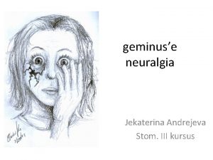 geminuse neuralgia Jekaterina Andrejeva Stom III kursus N