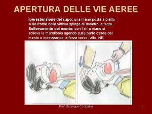 APERTURA DELLE VIE AEREE Iperestensione del capo una