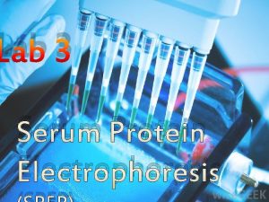 Lab 3 Serum Protein Electrophoresis Serum protein electrophoresis