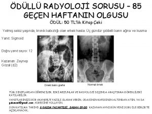 Direkt grafide kahve çekirdeği