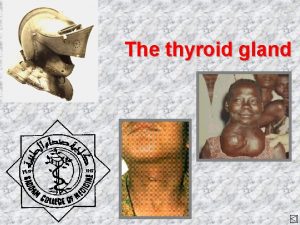 The thyroid gland The thyroid gland z Lobes