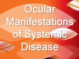 Ocular Manifestations of Systemic Disease Introduction OCULAR MANIFESTATIONS