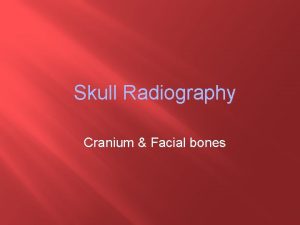Radiographic baseline skull
