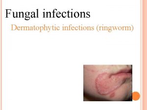Fungal infections Dermatophytic infections ringworm CAUSE Three genera