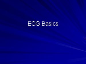 ECG Basics What is an ECG The electrocardiogram