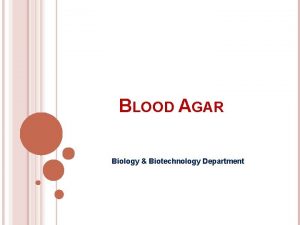BLOOD AGAR Biology Biotechnology Department PURPOSE Blood agar