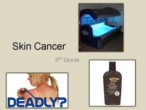 Skin Cancer 9 th Grade Skin Cancer Facts