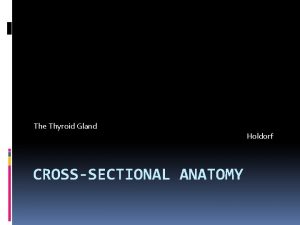 The Thyroid Gland CROSSSECTIONAL ANATOMY Holdorf Normal Anatomy