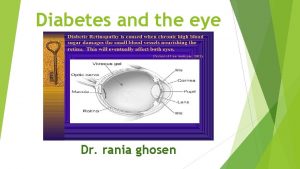 Diabetes and the eye Dr rania ghosen Diabetic