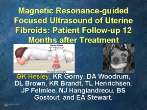 Magnetic Resonanceguided Focused Ultrasound of Uterine Fibroids Patient