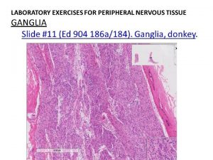 Rough Endoplasmic Reticulum and Polysomes Slide 148 Commercial