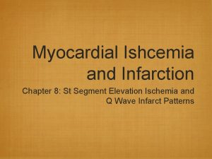 Myocardial Ishcemia and Infarction Chapter 8 St Segment