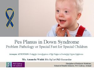 Pes Planus in Down Syndrome Problem Pathology or