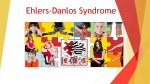 EhlersDanlos Syndrome What will we be covering What
