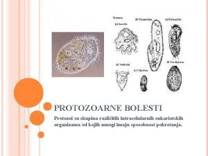 PROTOZOARNE BOLESTI Protozoi su skupina razliitih intracelularnih eukariotskih