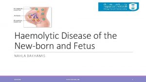 Haemolytic Disease of the Newborn and Fetus NAHLA