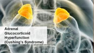 Adrenal Glucocorticoid Hyperfunction Cushings Syndrome What is Cushings